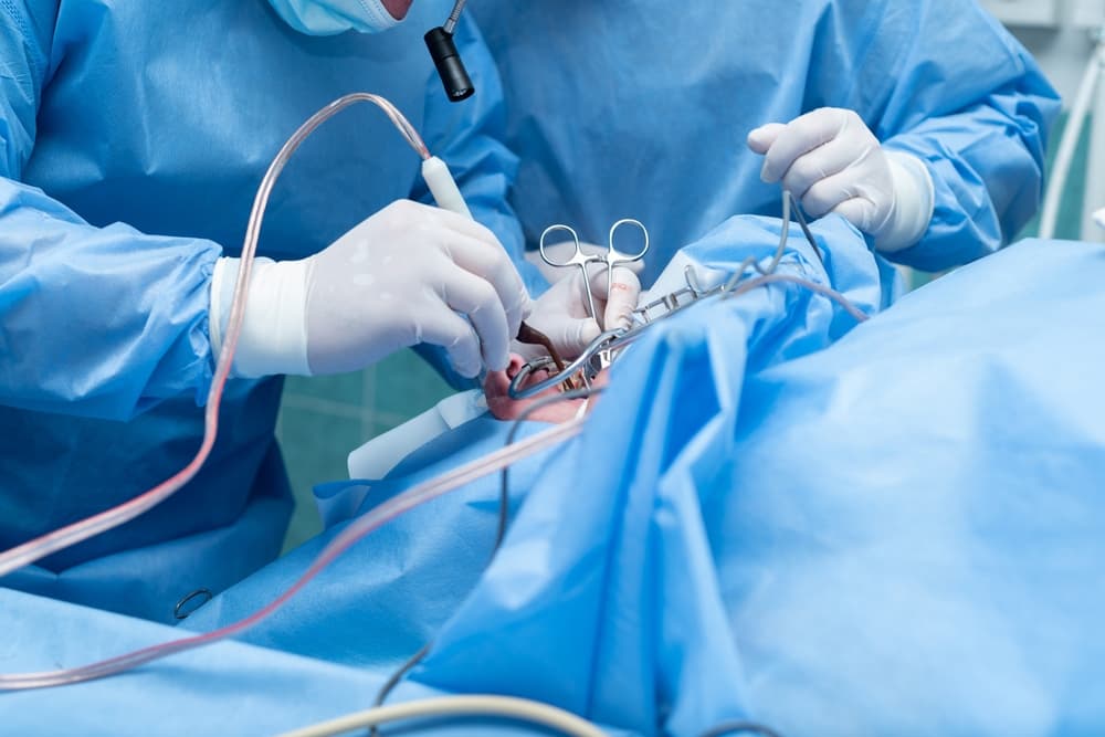 Operație amigdale palatine: Când este necesară și cum decurge intervenția de chirurgie ORL